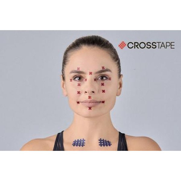 Acu Tape BB Acu Tape™ Body